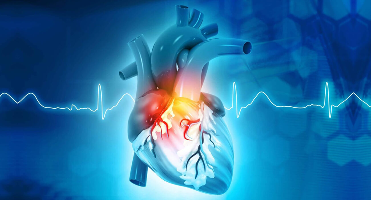 cardiologist
